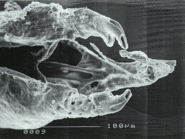 pedicellarien05