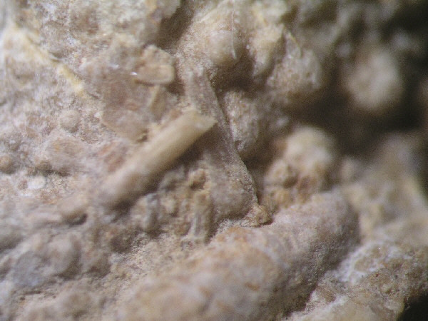 pedicellarien06