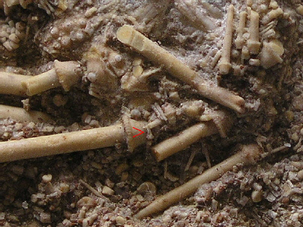pedicellarien07