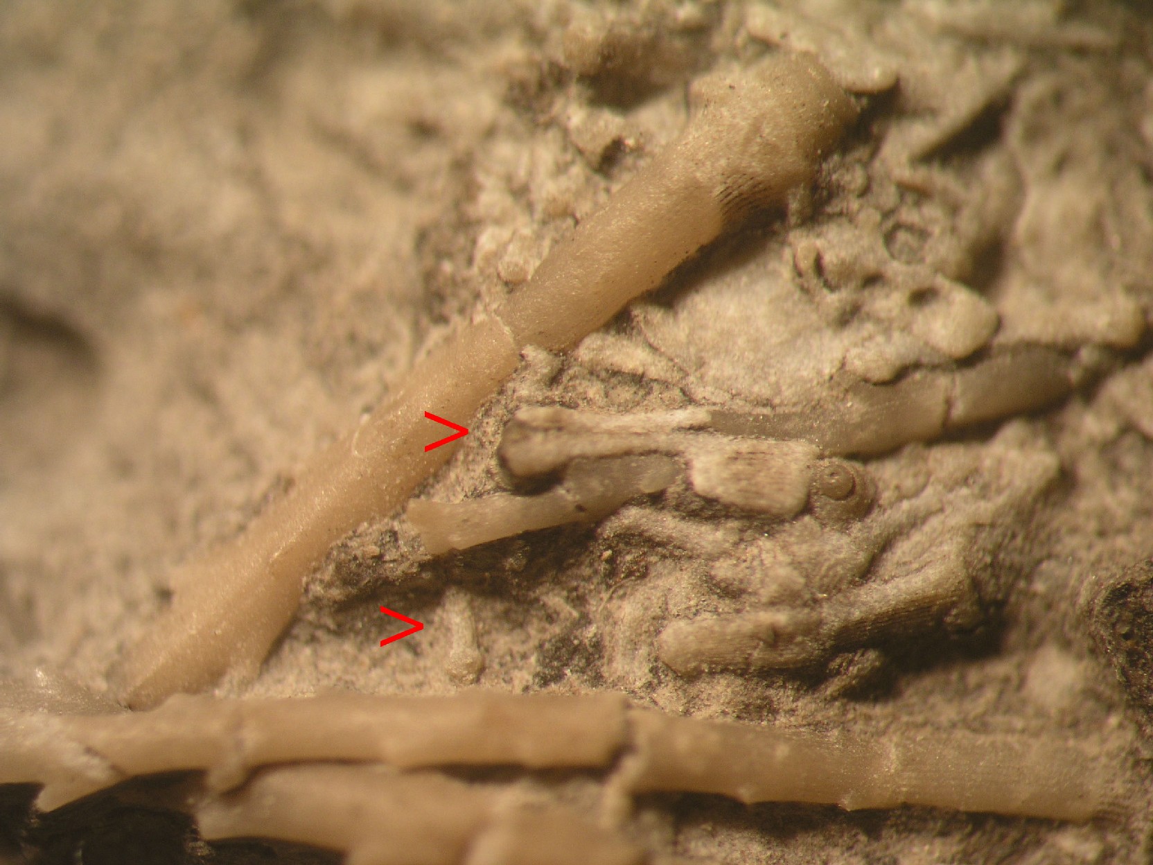 pedicellarien09