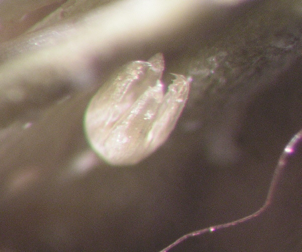 pedicellarien17b