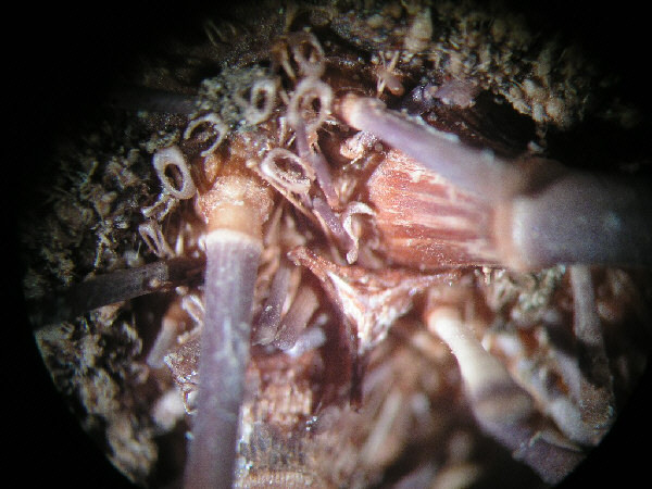 pedicellarien18a