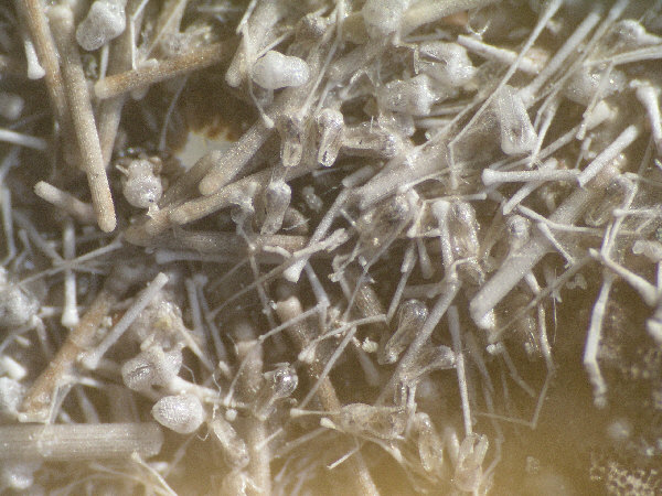 tripneustes gratilla 4