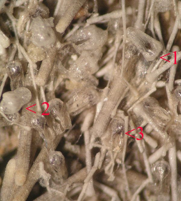 tripneustes gratilla 5
