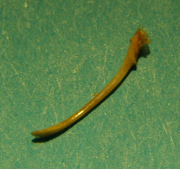Echinocardium6 7b