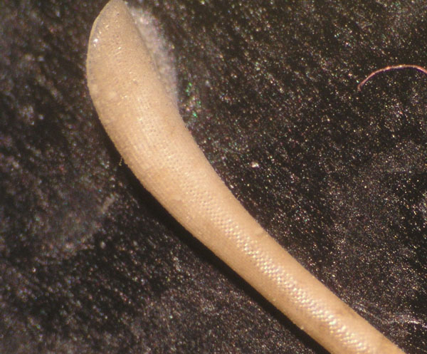 10b echinocardium